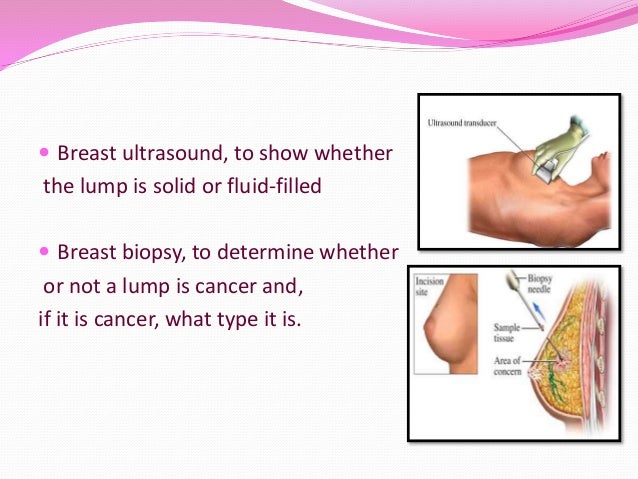 cylinrical breast cancer Female p o v porn videos
